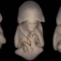 Эмбрион летучей мыши. Светлопольная микрофотография трех эмбрионов чёрного молоса (вид летучих мышей) на прогрессивной стадии развития. Чуть позже их крылья начнут удлиняться, а уши — становиться больше. (Dorit Hockman/Nikon Small World).